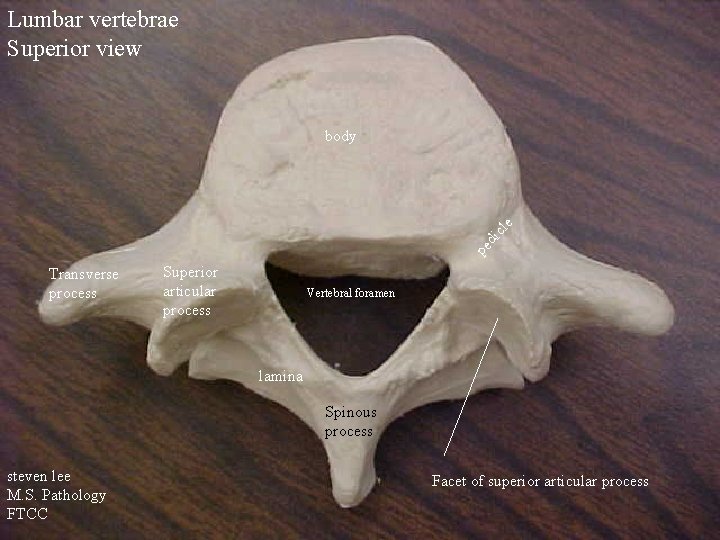 Lumbar vertebrae Superior view pe d icl e body Transverse process Superior articular process
