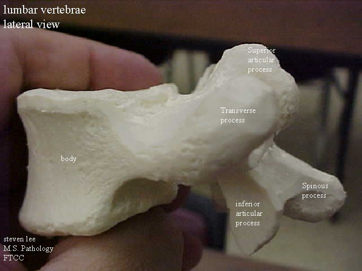 lumbar vertebrae lateral view Superior articular process Transverse process body inferior articular process steven
