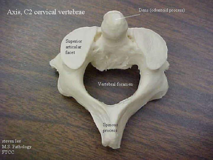 Dens (odontoid process) Axis, C 2 cervical vertebrae Superior articular facet Vertebral foramen Spinous