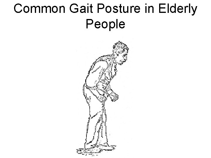 Common Gait Posture in Elderly People 