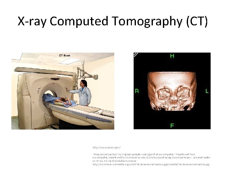 X-ray Computed Tomography (CT) http: //www. cancer. gov/ "Bonereconstruction" by Original uploader was Zgyorfi