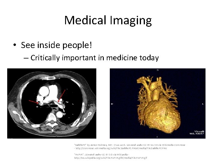 Medical Imaging • See inside people! – Critically important in medicine today "Saddle. PE"