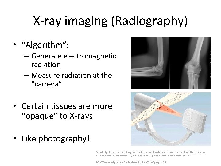 X-ray imaging (Radiography) • “Algorithm”: – Generate electromagnetic radiation – Measure radiation at the