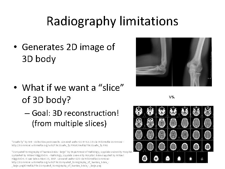 Radiography limitations • Generates 2 D image of 3 D body • What if