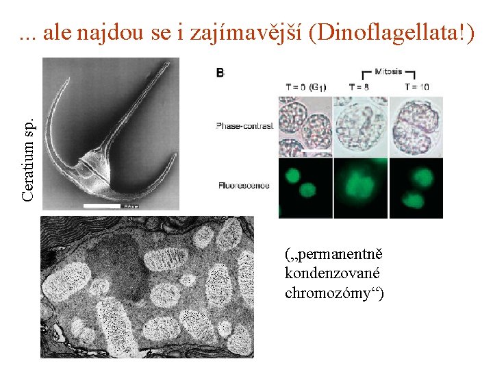 Ceratium sp. . ale najdou se i zajímavější (Dinoflagellata!) („permanentně kondenzované chromozómy“) 
