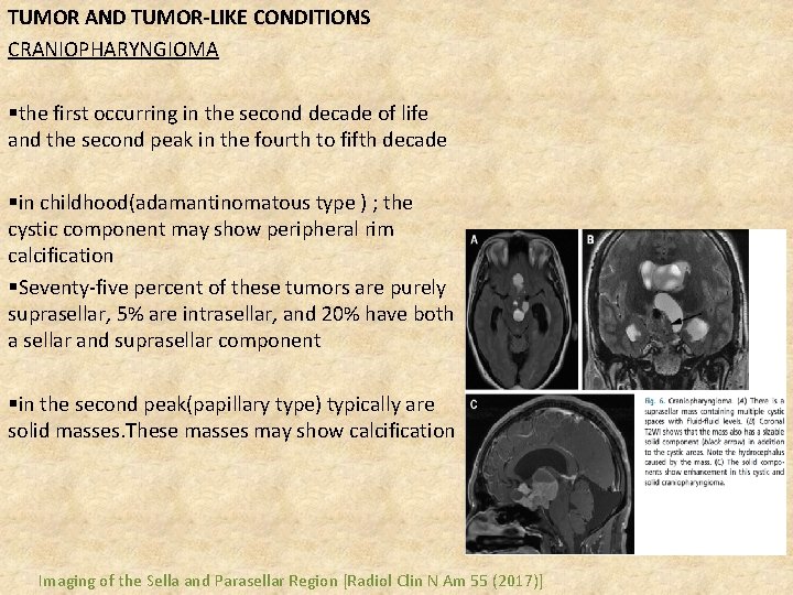 TUMOR AND TUMOR-LIKE CONDITIONS CRANIOPHARYNGIOMA §the first occurring in the second decade of life