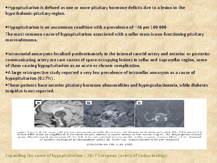 §Hypopituitarism is defined as one or more pituitary hormone deficits due to a lesion