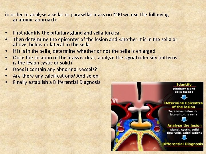 in order to analyse a sellar or parasellar mass on MRI we use the