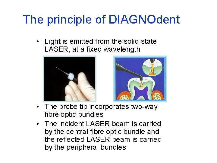 The principle of DIAGNOdent • Light is emitted from the solid-state LASER, at a