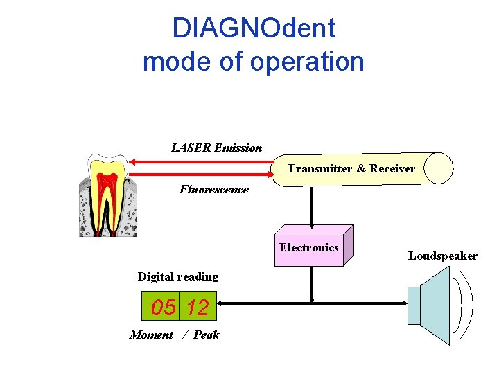 DIAGNOdent mode of operation LASER Emission Transmitter & Receiver Fluorescence Electronics Digital reading 05