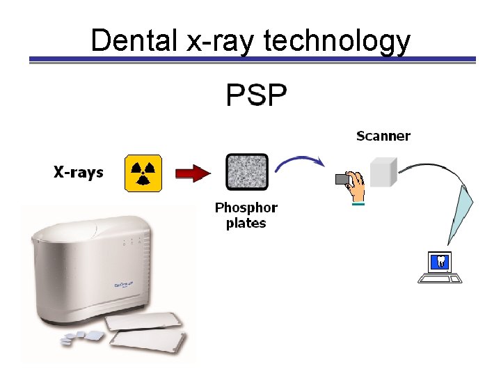 Dental x-ray technology 