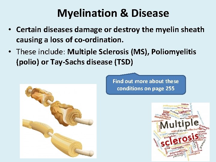 Myelination & Disease • Certain diseases damage or destroy the myelin sheath causing a