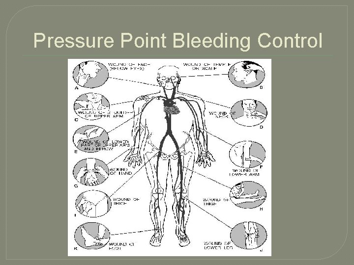 Pressure Point Bleeding Control 