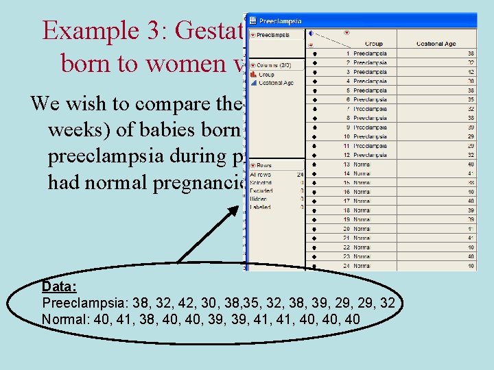 Example 3: Gestational age of babies born to women with preeclampsia We wish to