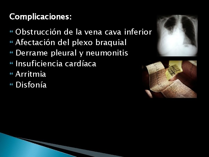 Complicaciones: Obstrucción de la vena cava inferior Afectación del plexo braquial Derrame pleural y