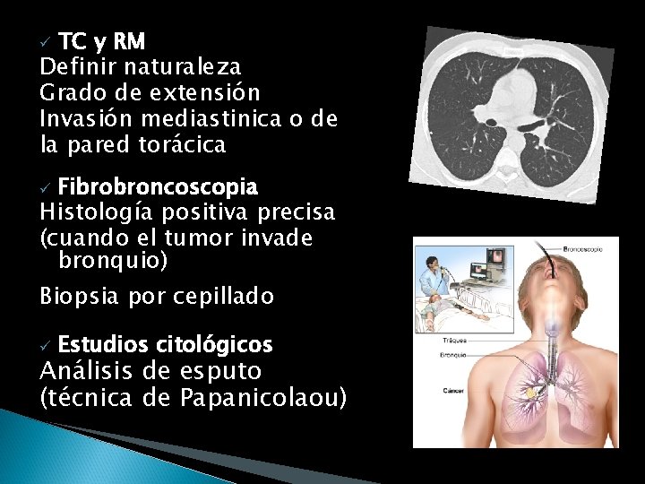 TC y RM Definir naturaleza Grado de extensión Invasión mediastinica o de la pared
