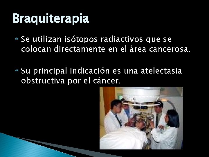 Braquiterapia Se utilizan isótopos radiactivos que se colocan directamente en el área cancerosa. Su