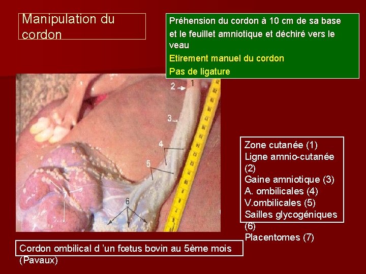 Manipulation du cordon Préhension du cordon à 10 cm de sa base et le