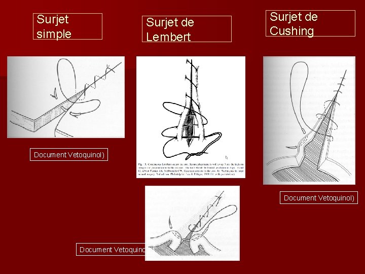 Surjet simple Surjet de Lembert Surjet de Cushing Document Vetoquinol) 