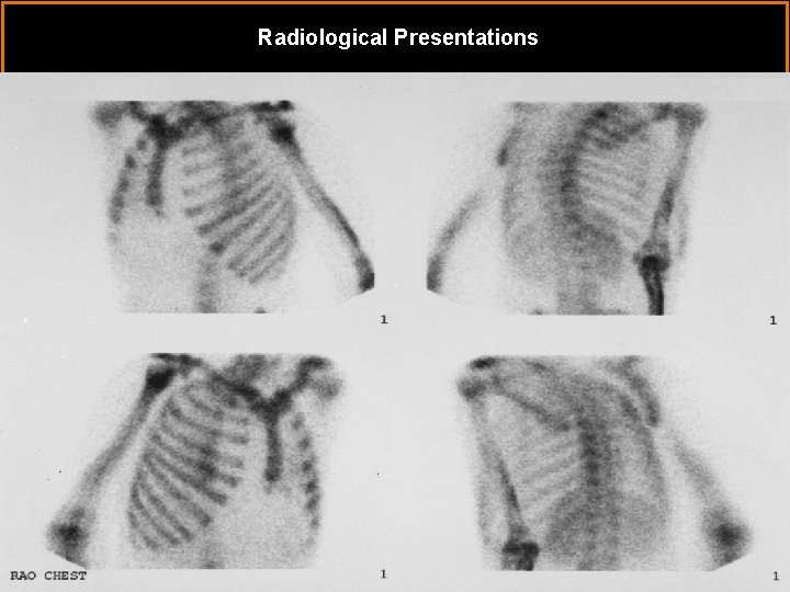 Radiological Presentations 