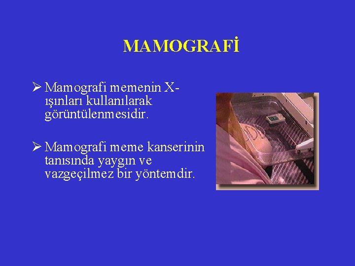 MAMOGRAFİ Ø Mamografi memenin Xışınları kullanılarak görüntülenmesidir. Ø Mamografi meme kanserinin tanısında yaygın ve MAMOGRAFİ Ø Mamografi memenin Xışınları kullanılarak görüntülenmesidir. Ø Mamografi meme kanserinin tanısında yaygın ve