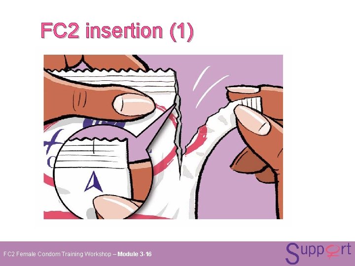 FC 2 insertion (1) FC 2 Female Condom Training Workshop – Module 3 -16 FC 2 insertion (1) FC 2 Female Condom Training Workshop – Module 3 -16