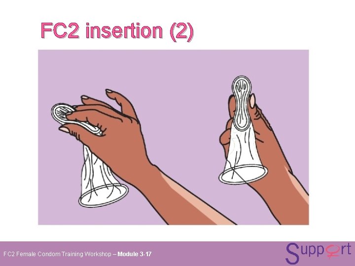 FC 2 insertion (2) FC 2 Female Condom Training Workshop – Module 3 -17 FC 2 insertion (2) FC 2 Female Condom Training Workshop – Module 3 -17