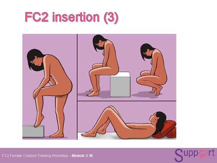 FC 2 insertion (3) FC 2 Female Condom Training Workshop – Module 3 -18 FC 2 insertion (3) FC 2 Female Condom Training Workshop – Module 3 -18