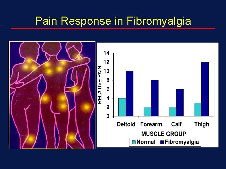 RELATIVE PAIN Pain Response in Fibromyalgia 