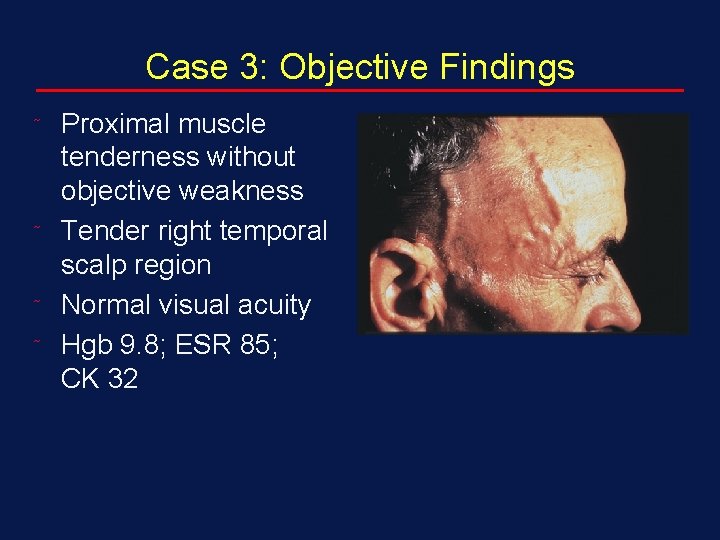 Case 3: Objective Findings ˜ ˜ Proximal muscle tenderness without objective weakness Tender right