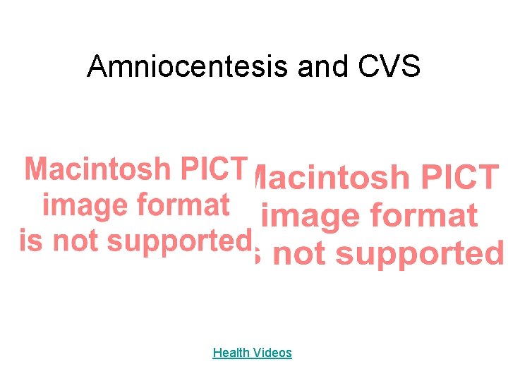Amniocentesis and CVS Health Videos 
