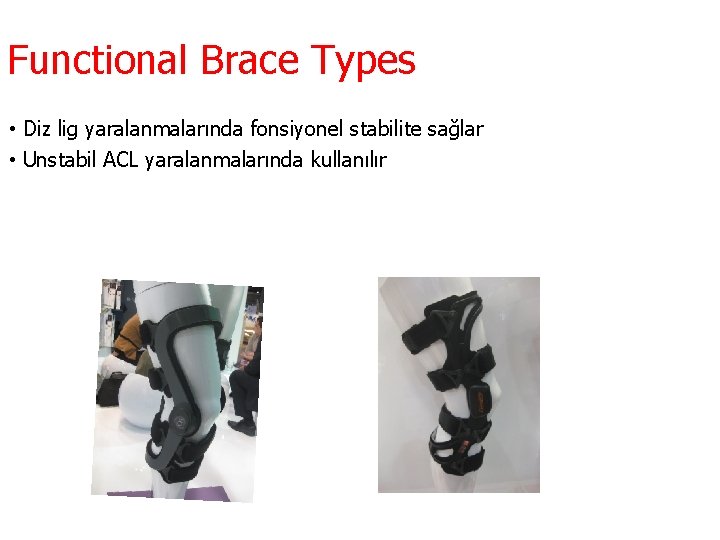 Functional Brace Types • Diz lig yaralanmalarında fonsiyonel stabilite sağlar • Unstabil ACL yaralanmalarında