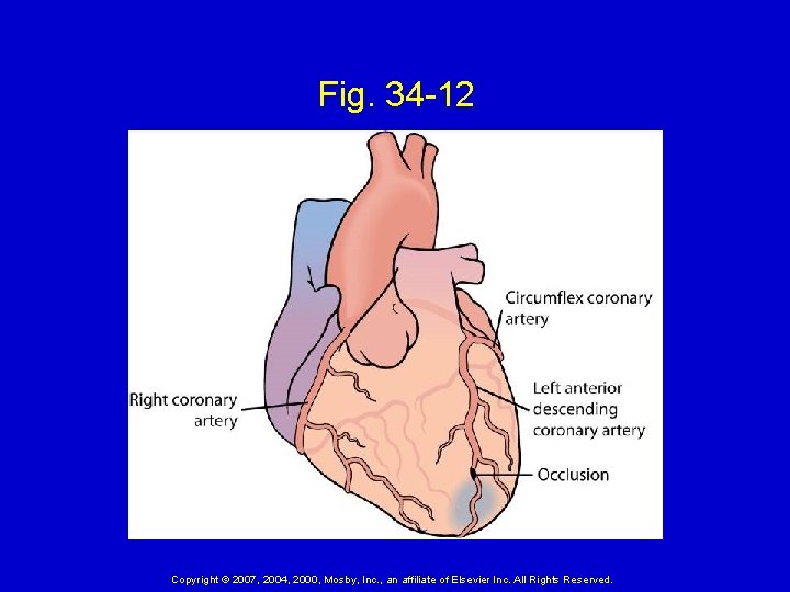 Fig. 34 -12 Copyright © 2007, 2004, 2000, Mosby, Inc. , an affiliate of