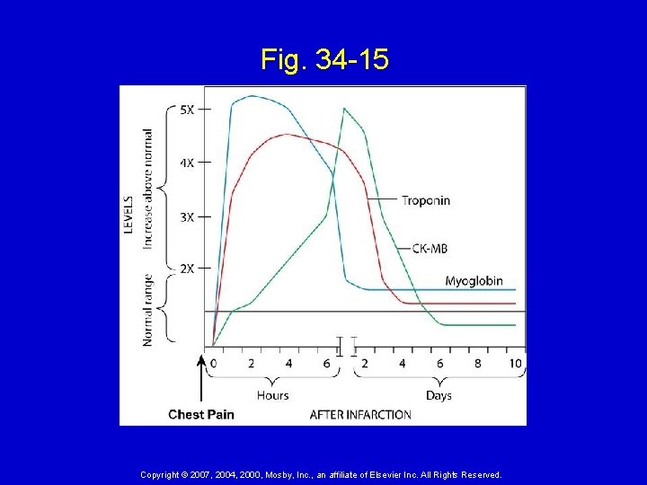 Fig. 34 -15 Copyright © 2007, 2004, 2000, Mosby, Inc. , an affiliate of