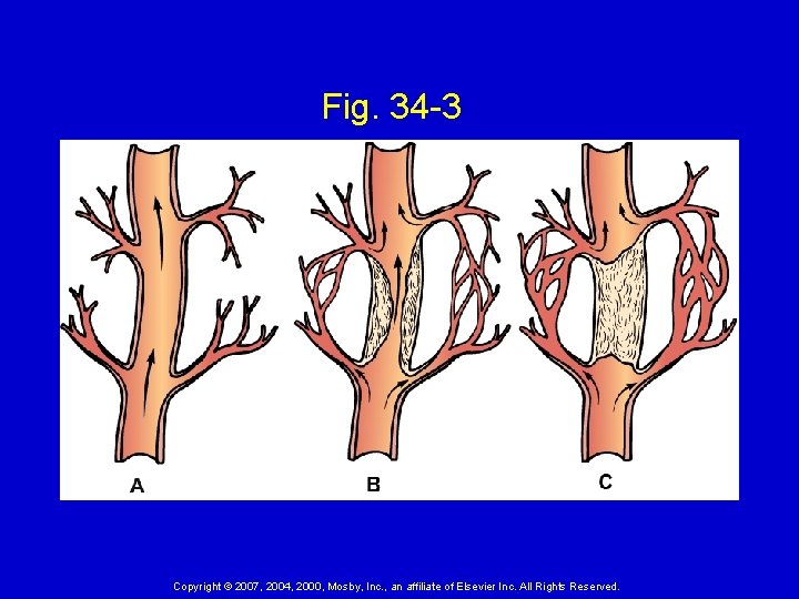 Fig. 34 -3 Copyright © 2007, 2004, 2000, Mosby, Inc. , an affiliate of