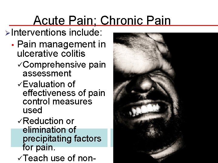 Acute Pain; Chronic Pain ØInterventions include: • Pain management in ulcerative colitis üComprehensive pain