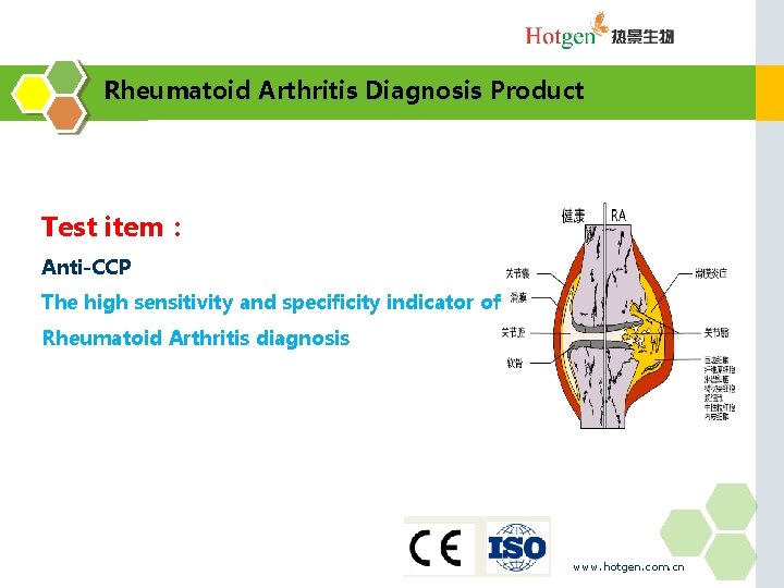 Rheumatoid Arthritis Diagnosis Product Test item： Anti-CCP The high sensitivity and specificity indicator of