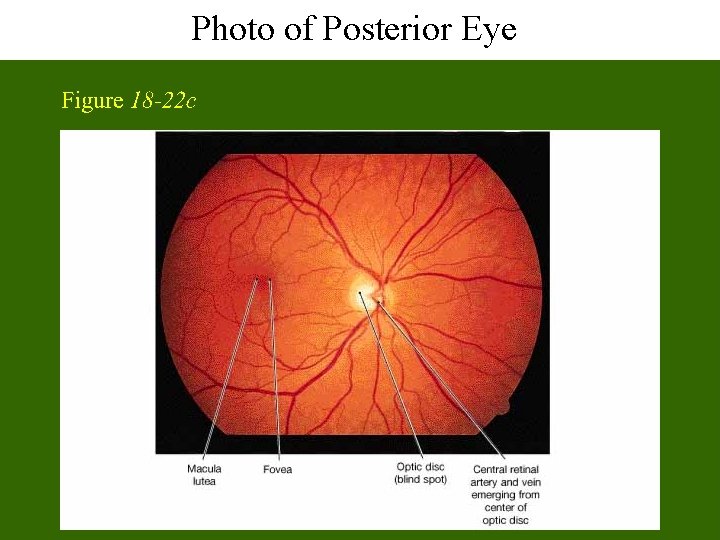 Photo of Posterior Eye 