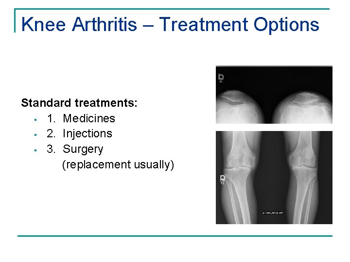 Knee Arthritis – Treatment Options Standard treatments: § 1. Medicines § 2. Injections §