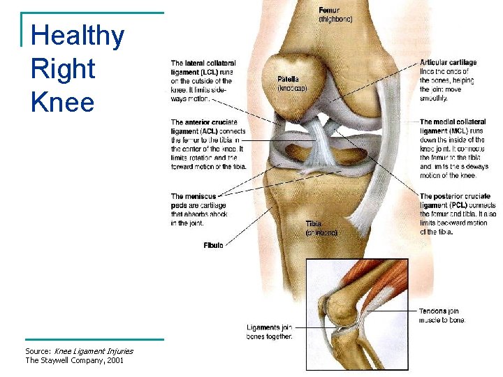 Healthy Right Knee Source: Knee Ligament Injuries The Staywell Company, 2001 