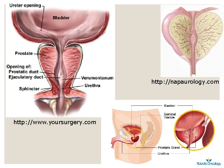 http: //napaurology. com http: //www. yoursurgery. com 