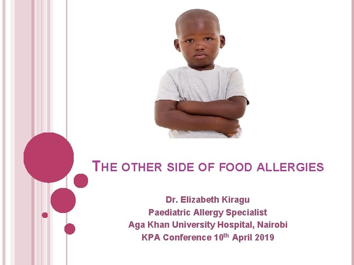 THE OTHER SIDE OF FOOD ALLERGIES Dr. Elizabeth Kiragu Paediatric Allergy Specialist Aga Khan