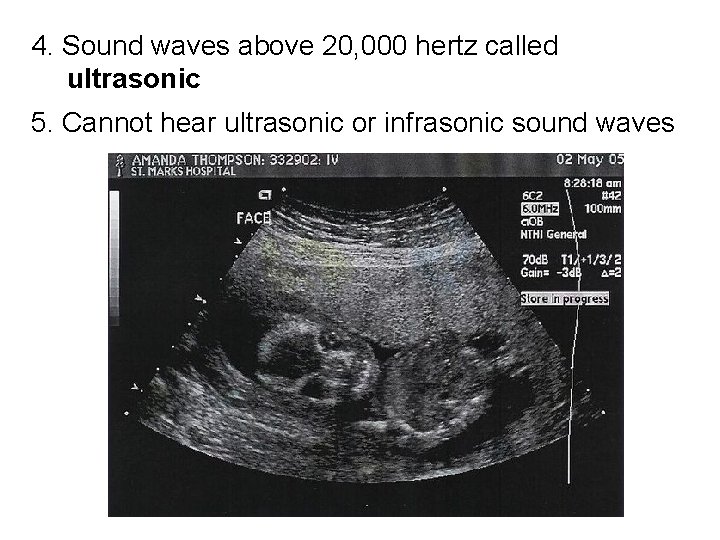 4. Sound waves above 20, 000 hertz called ultrasonic 5. Cannot hear ultrasonic or