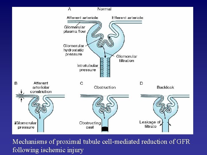Mechanisms of proximal tubule cell-mediated reduction of GFR following ischemic injury 
