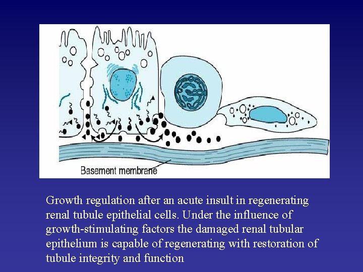 Growth regulation after an acute insult in regenerating renal tubule epithelial cells. Under the