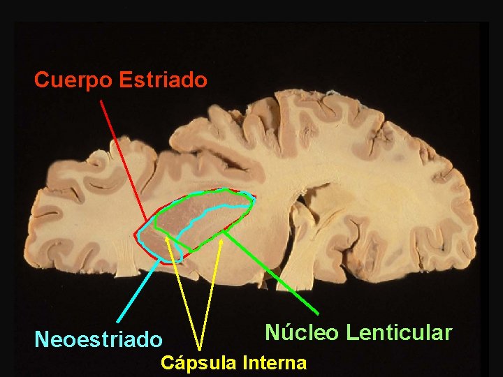 Cuerpo Estriado Neoestriado Núcleo Lenticular Cápsula Interna 