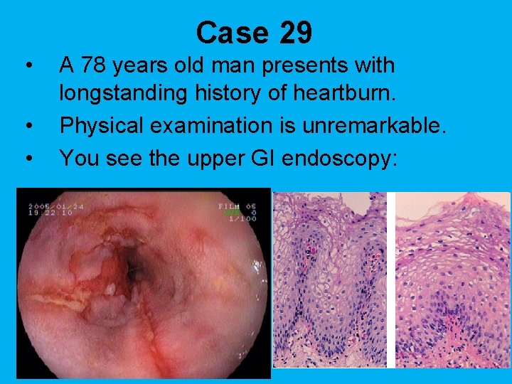 Case 29 • • • A 78 years old man presents with longstanding history