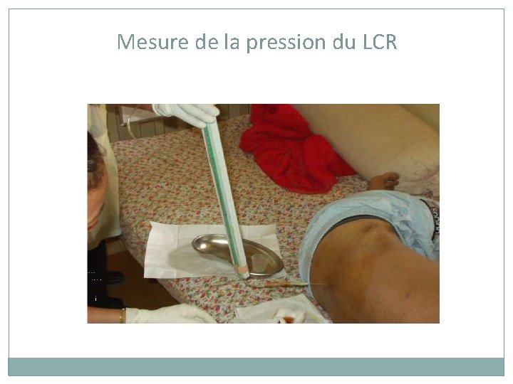 Mesure de la pression du LCR 