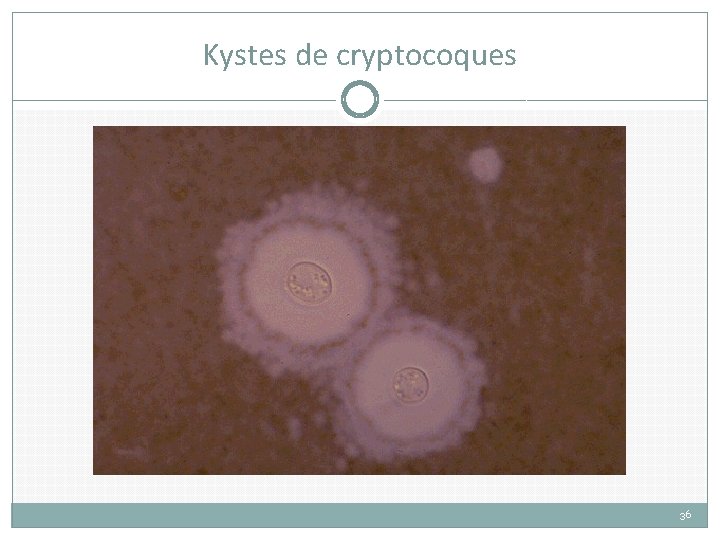 Kystes de cryptocoques 36 