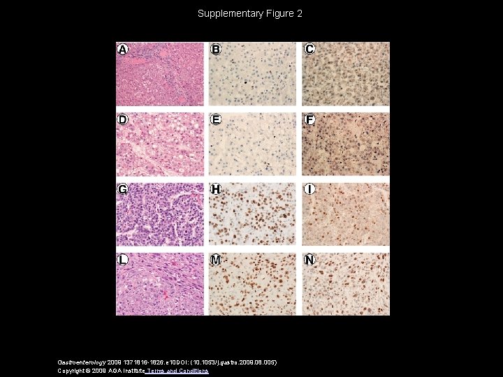 Supplementary Figure 2 Gastroenterology 2009 1371816 -1826. e 10 DOI: (10. 1053/j. gastro. 2009.